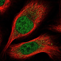 CBX7 Antibody, Novus Biologicals:Antibodies:Primary Antibodies